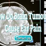 How Do Brain Tumours Cause Ear Pain – Including Aneurysms