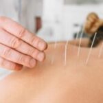 Can Acupuncture Help During Pregnancy? Yes, It Can!