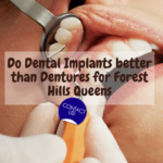 Do Dental Implants better than Dentures for Forest Hills Queens, NY ?