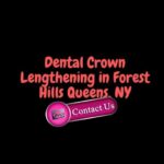 Dental Crown Lengthening in Forest Hills Queens, NY