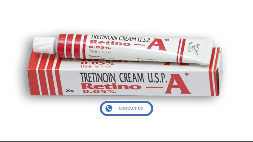 Does Tretinoin Cream Work for Acne Treatment?