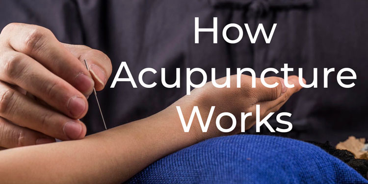 A Crash Course in Understanding How Acupuncture Works