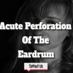 An Eardrum Has Ruptured—Acute Perforation Of The Eardrum.