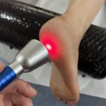 High-Intensity Laser Therapy: Find Local Specialists