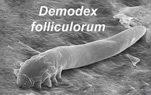 Demodex Mites and Their Connection to Chronic Dry Eye